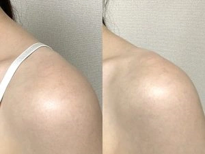 第一三共TRANSINO
