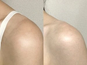 第一三共TRANSINO